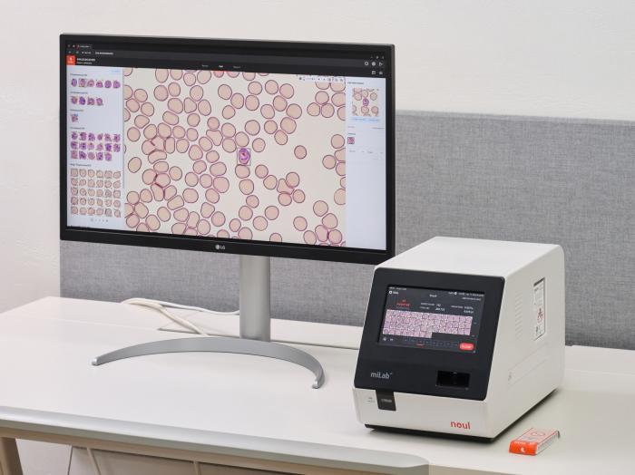 노을, 우간다에 마이랩 공급…중저소득국 비즈니스 수익성 개선 가시화