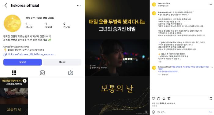 한국노바티스, '화농성 한선염에 빛을 비추다' 공식 인스타그램 채널 개설