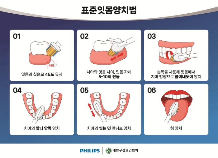 부모님 위한 임플란트, 시술보다 중요한 ‘사후관리’
