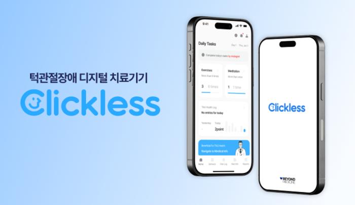 케이메디허브 지원, ‘클릭리스’ 신의료기술평가 유예 대상 선정